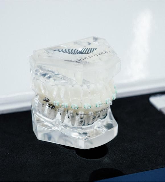 TG Orthodontics présente les bagues Lightforce pour des transformations de sourire personnalisées