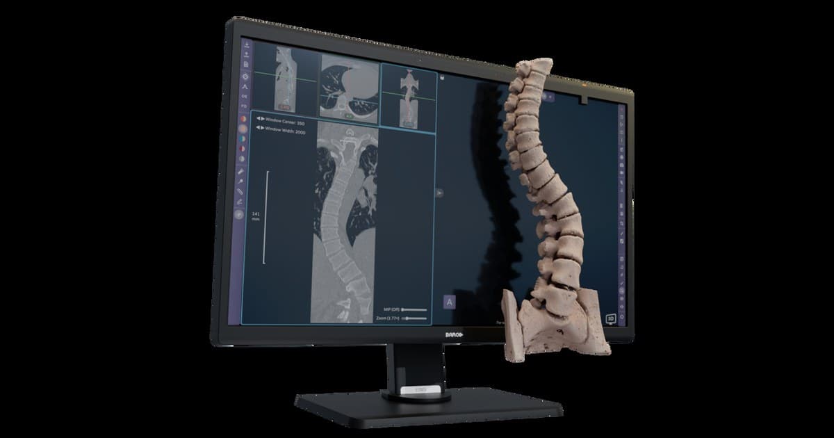 Avatar Medical obtient le marquage CE pour son logiciel de visualisation médicale 3D sans lunettes