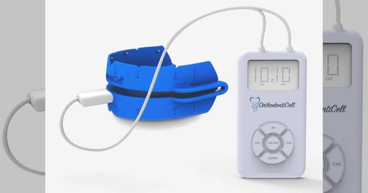 OrthodontiCell obtient des capitaux pour achever les tests de l'étude pivot de phase II prévue aux États-Unis