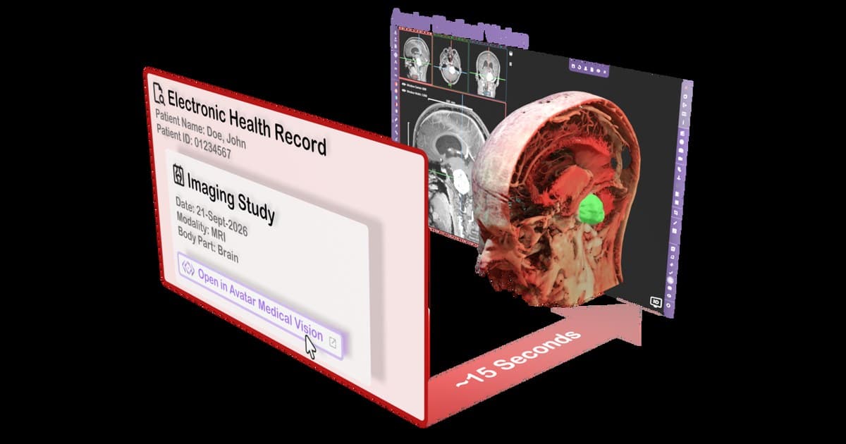Avatar Medical intègre l'imagerie 3D propre au patient à l'EHR Epic pour fluidifier les consultations cliniques